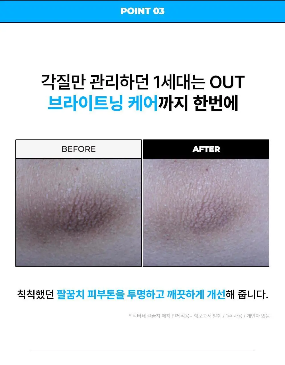 [NEW] 닥터빼 꿀꿈치 패치 1set * 4매 상세페이지 30